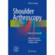 Shoulder Arthroscopy: How to Succeed!