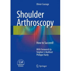 Shoulder Arthroscopy: How to Succeed!