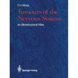 Tumours of the Nervous System: an Ultrastructural Atlas