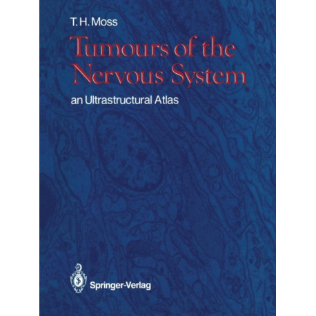 Tumours of the Nervous System: an Ultrastructural Atlas