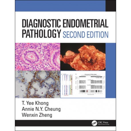 Diagnostic Endometrial Pathology 2E