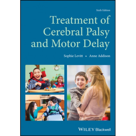 Treatment of Cerebral Palsy and Motor Delay