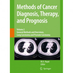 Methods of Cancer Diagnosis, Therapy and Prognosis: General Methods and Overviews, Lung Carcinoma and Prostate Carcinoma