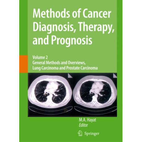 Methods of Cancer Diagnosis, Therapy and Prognosis: General Methods and Overviews, Lung Carcinoma and Prostate Carcinoma