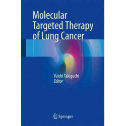 Molecular Targeted Therapy of Lung Cancer