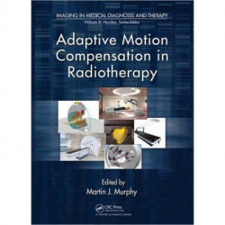 Adaptive Motion Compensation in Radiotherapy