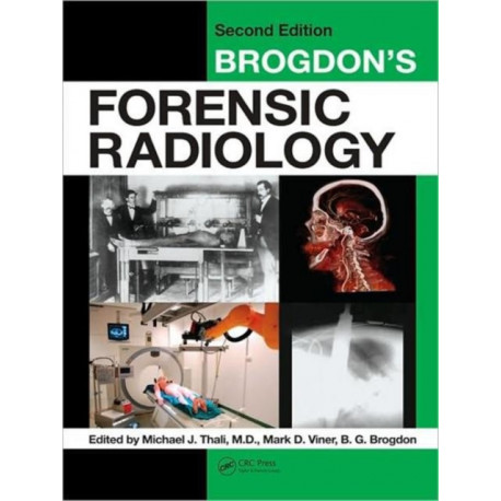 Brogdon's Forensic Radiology