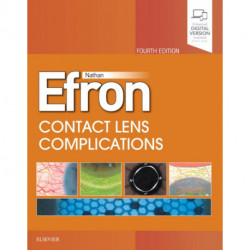 Contact Lens  Complications: Expert Consult - Online and Print