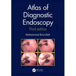 Atlas of Diagnostic Endoscopy, 3E