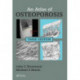 An Atlas of Osteoporosis