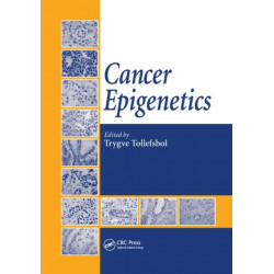 Cancer Epigenetics