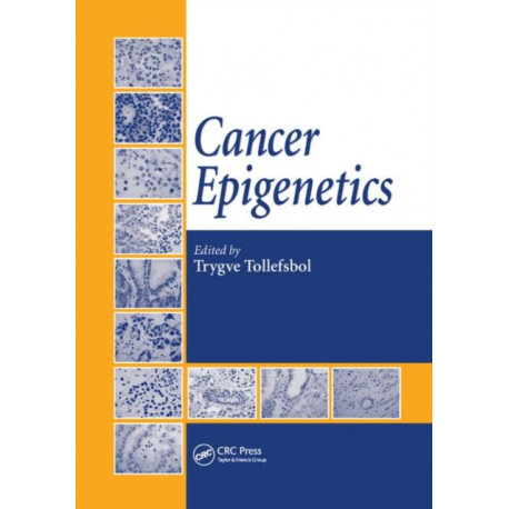 Cancer Epigenetics