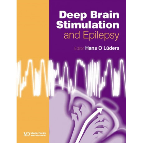 Deep Brain Stimulation and Epilepsy