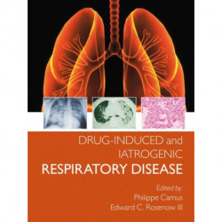 Drug-induced and Iatrogenic Respiratory Disease