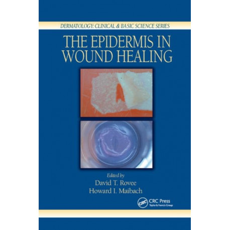 The Epidermis in Wound Healing