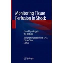 Monitoring Tissue Perfusion in Shock: From Physiology to the Bedside