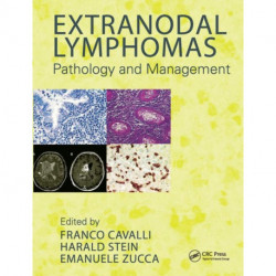 Extranodal Lymphomas: Pathology and Management