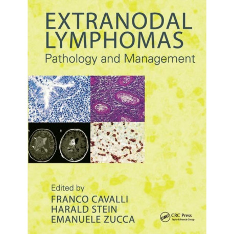 Extranodal Lymphomas: Pathology and Management
