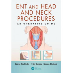 ENT and Head and Neck Procedures: An Operative Guide