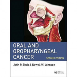 Oral and Oropharyngeal Cancer