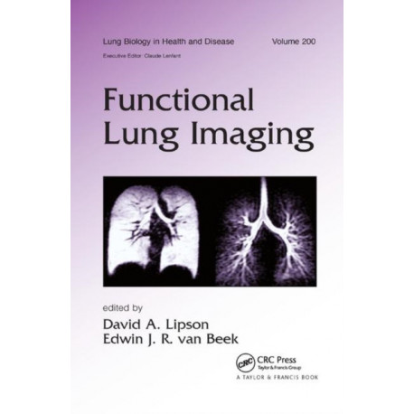 Functional Lung Imaging