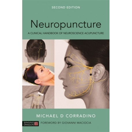Neuropuncture: A Clinical Handbook of Neuroscience Acupuncture