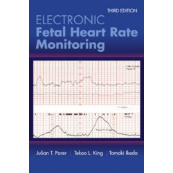 Electronic Fetal Heart Rate Monitoring: the 5-Tier System: The 5-Tier System