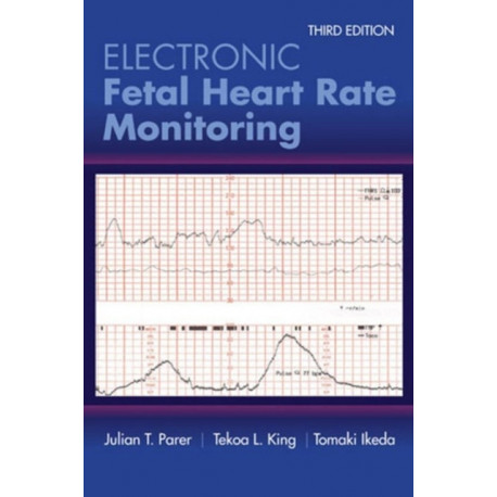 Electronic Fetal Heart Rate Monitoring: the 5-Tier System: The 5-Tier System
