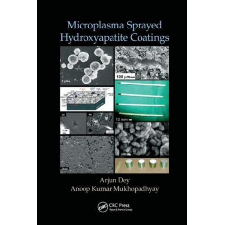 Microplasma Sprayed Hydroxyapatite Coatings