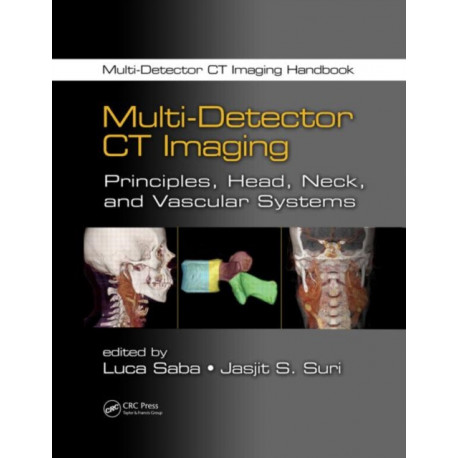 Multi-Detector CT Imaging: Principles, Head, Neck, and Vascular Systems