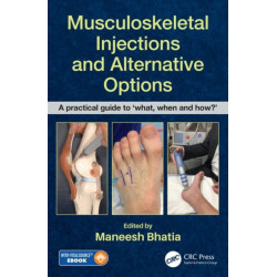 Musculoskeletal Injections and Alternative Options: A practical guide to 'what, when and how?'