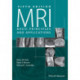 MRI: Basic Principles and Applications