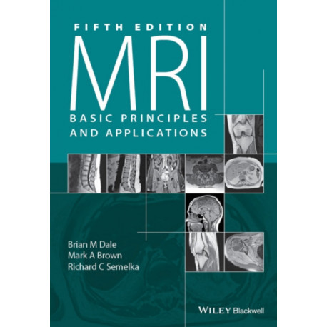 MRI: Basic Principles and Applications