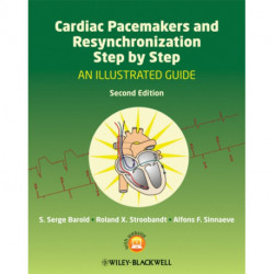 Cardiac Pacemakers and Resynchronization Step by Step: An Illustrated Guide