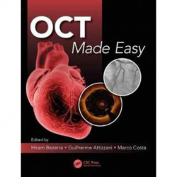 OCT Made Easy