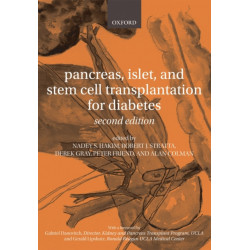 Pancreas, Islet and Stem Cell Transplantation for Diabetes