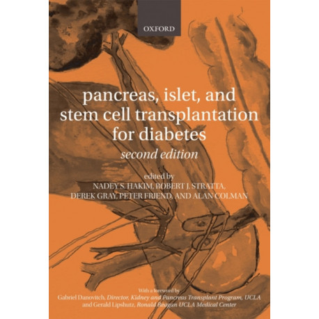 Pancreas, Islet and Stem Cell Transplantation for Diabetes