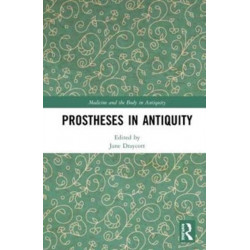 Prostheses in Antiquity
