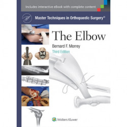 Master Techniques in Orthopaedic Surgery: The Elbow