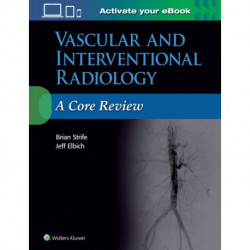 Vascular and Interventional Radiology: A Core Review