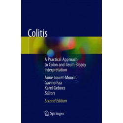 Colitis: A Practical Approach to Colon and Ileum Biopsy Interpretation
