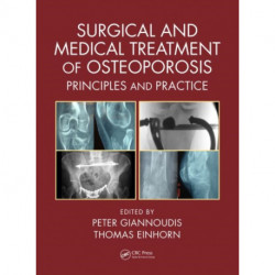 Surgical and Medical Treatment of Osteoporosis: Principles and Practice