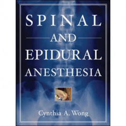Spinal and Epidural Anesthesia