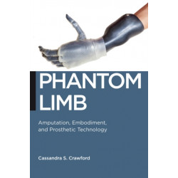 Phantom Limb: Amputation, Embodiment, and Prosthetic Technology
