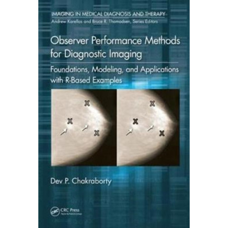 Observer Performance Methods for Diagnostic Imaging: Foundations, Modeling, and Applications with R-Based Examples