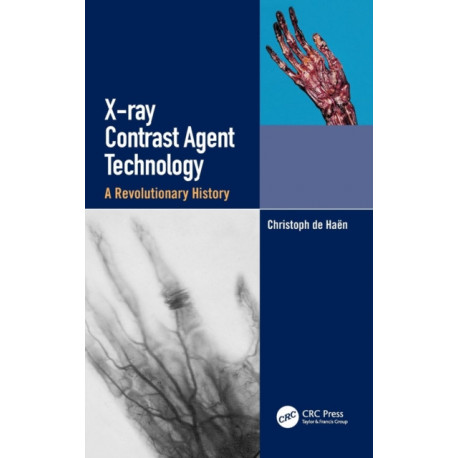 X-ray Contrast Agent Technology: A Revolutionary History