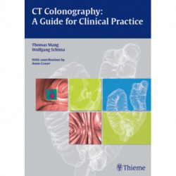CT Colonography: a Guide for Clinical Practice