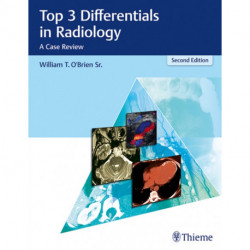 Top 3 Differentials in Radiology: A Case Review