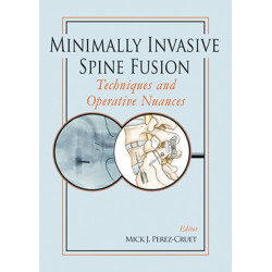 Minimally Invasive Spine Fusion: Techniques and Operative Nuances