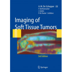Imaging of Soft Tissue Tumors